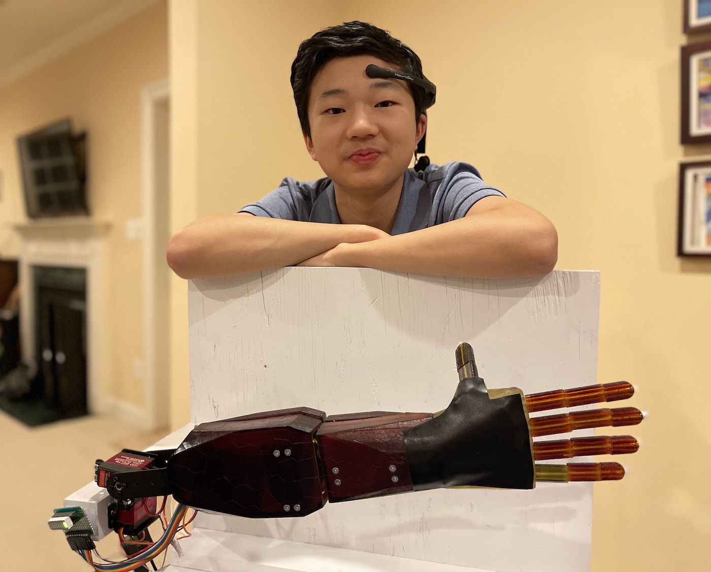 A High School Student Invented An Affordable BrainReading Prosthetic