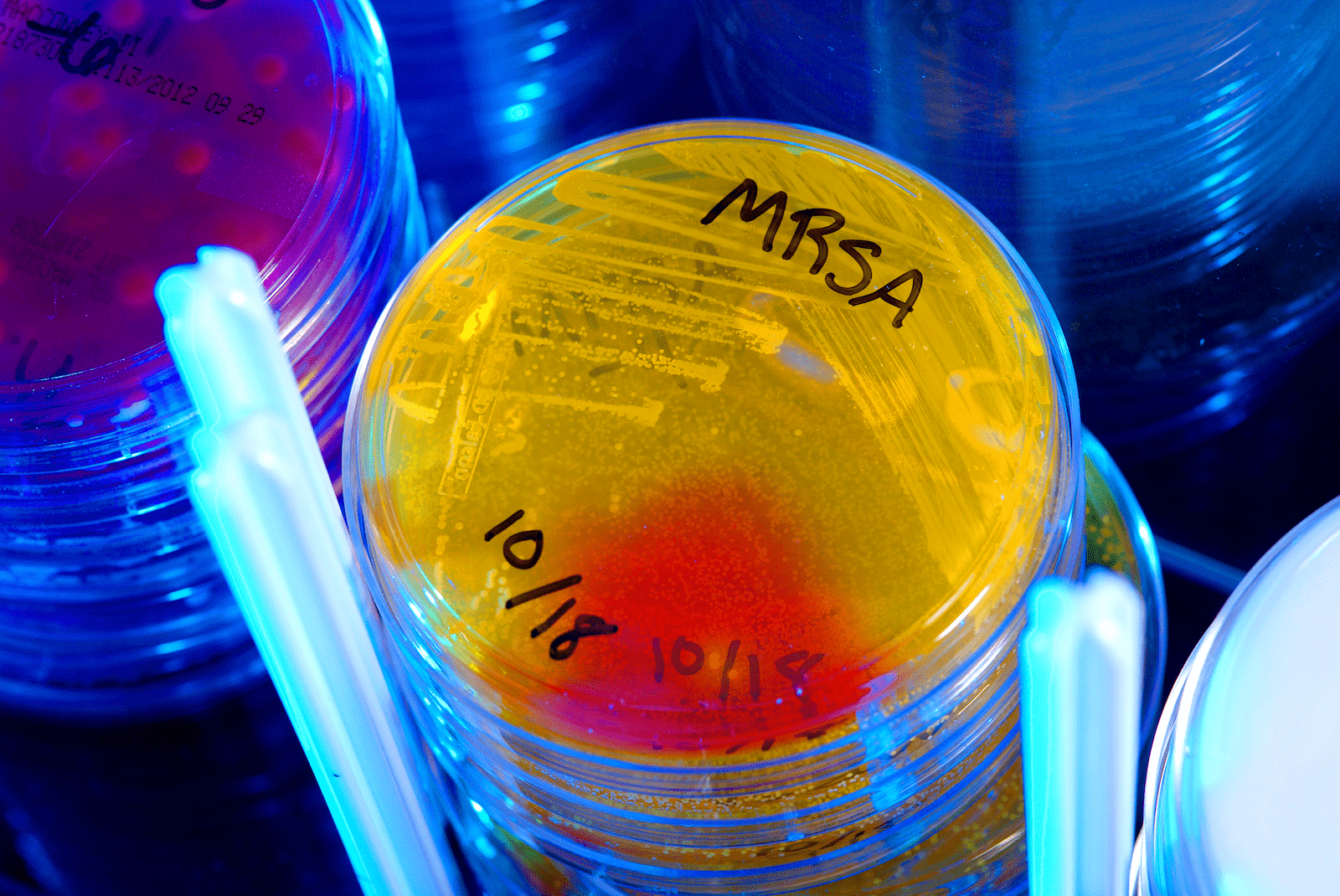various petri dishes in stacks under blue light. in the center of the image is a stack of yellow glowing plates. the top one reads "mrsa 10/18"