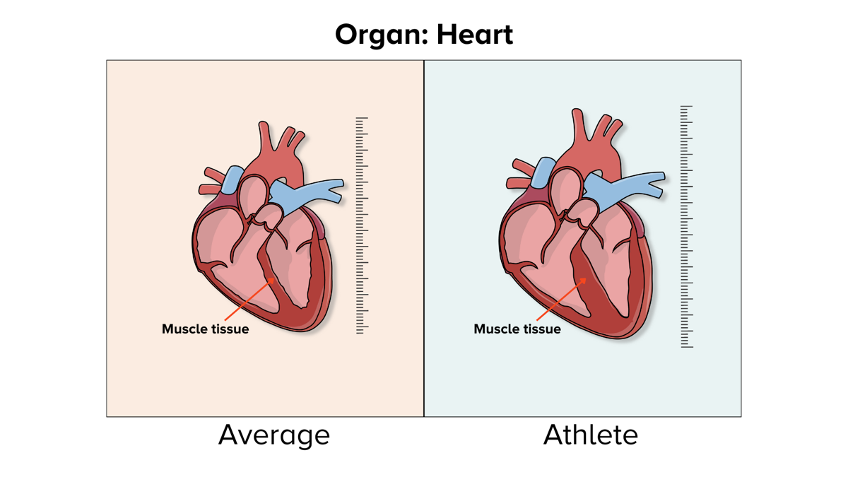 An illustration shows an average, smaller, less muscular heart on the left and an athlete's larger, more muscular heart on the right.