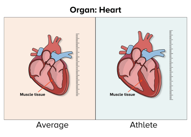 An illustration shows an average, smaller, less muscular heart on the left and an athlete's larger, more muscular heart on the right.