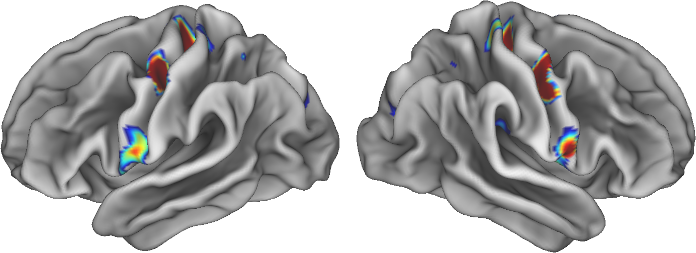 two gray 3d brain scans with a few regions in both the left and right lobes highlighted in rainbow colors