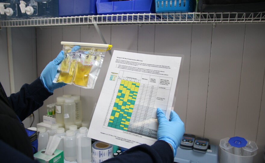 A plastic bag of yellow water is held next to a colorful chart. 