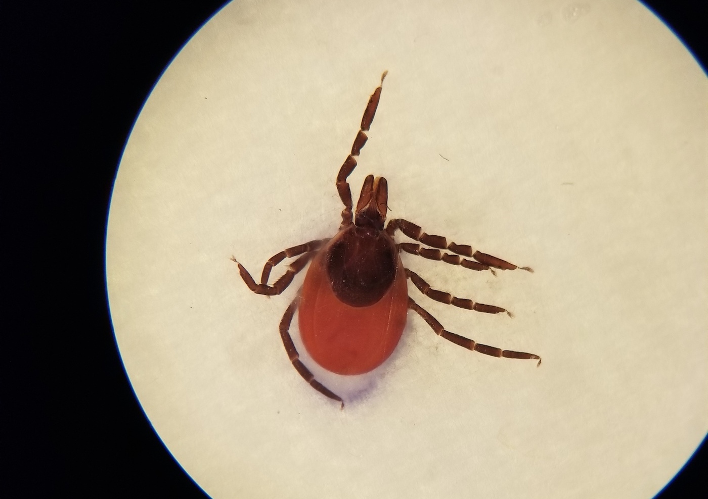 A tick under a microscope.