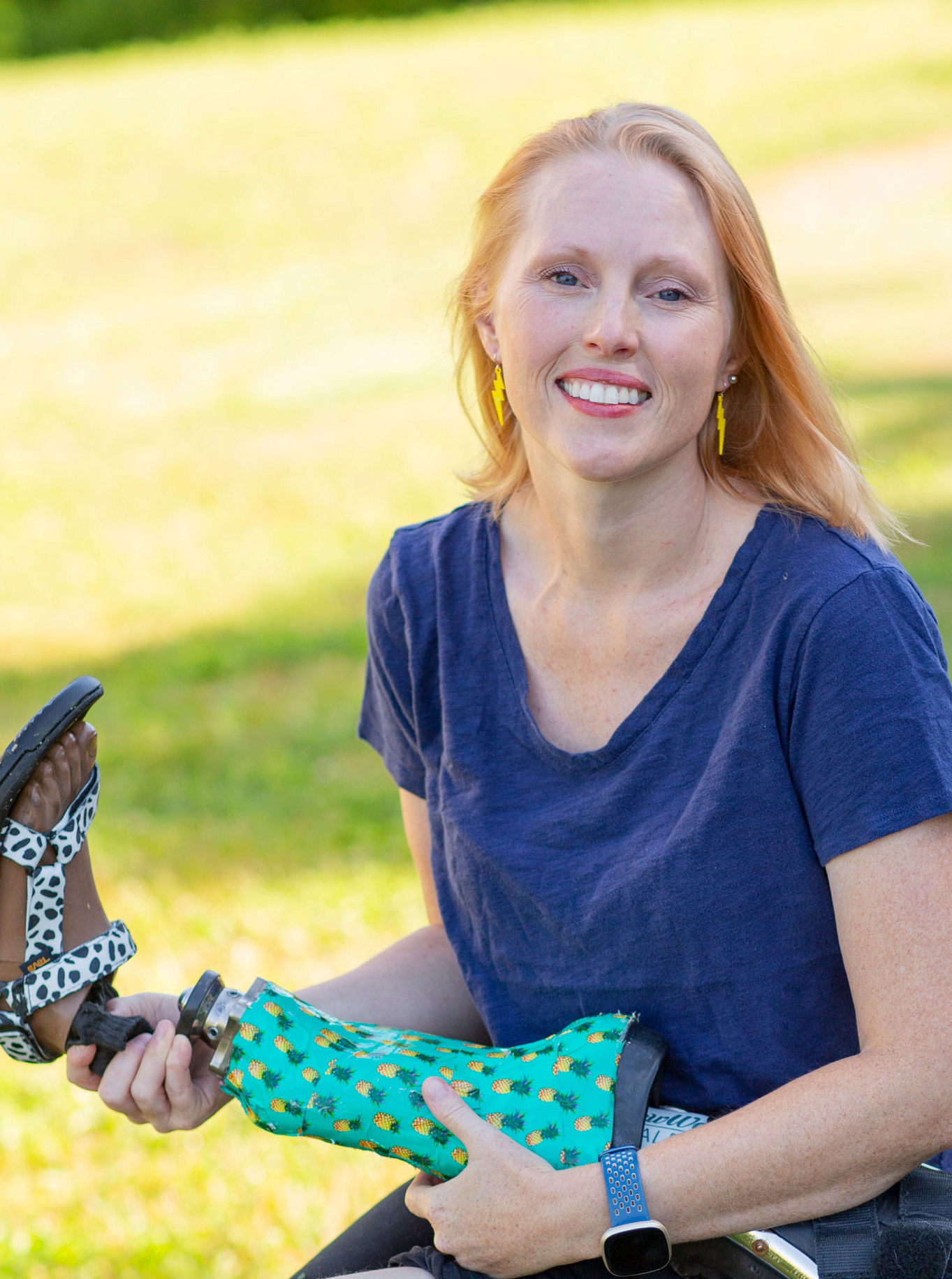 A white woman sitting outside in the sun smiles while holding a prosthetic leg with a sandal on the foot