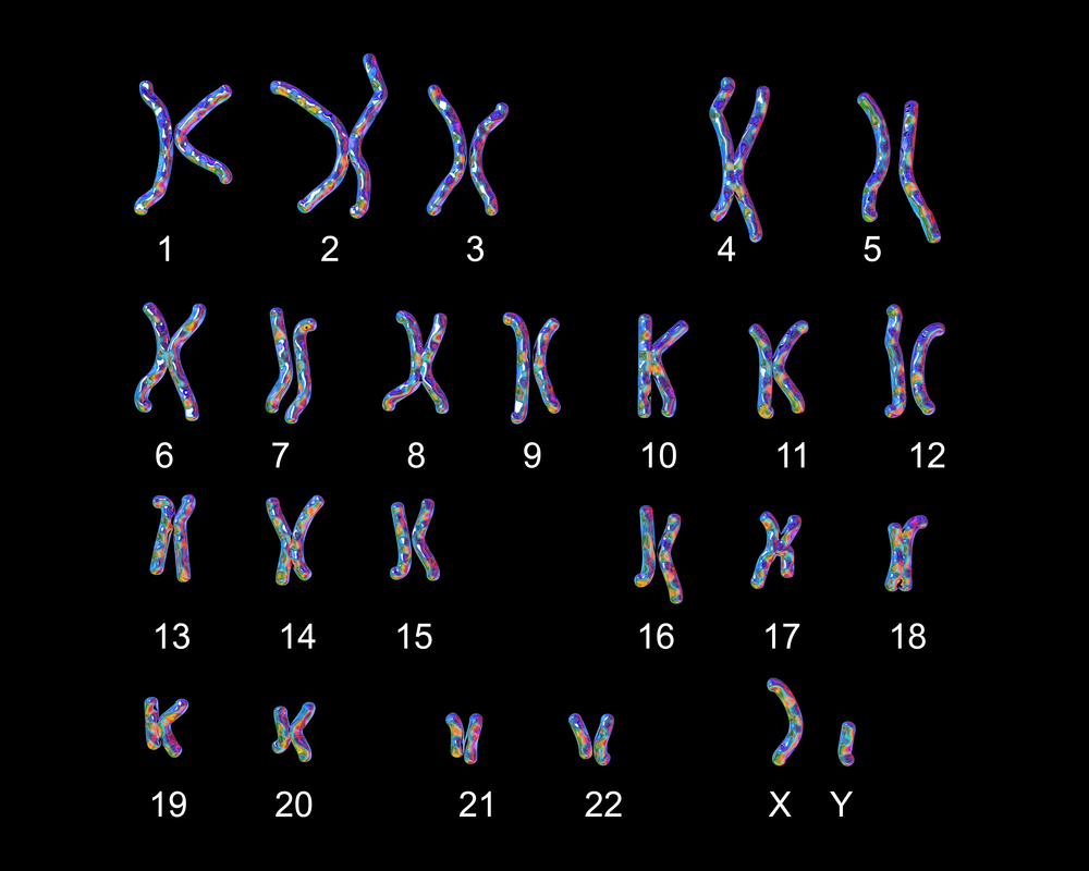 23 chromosomes of a human male laid out. the sex chromosomes on the right bottom corner are labeled x and y. the x chromosome is longer than the y