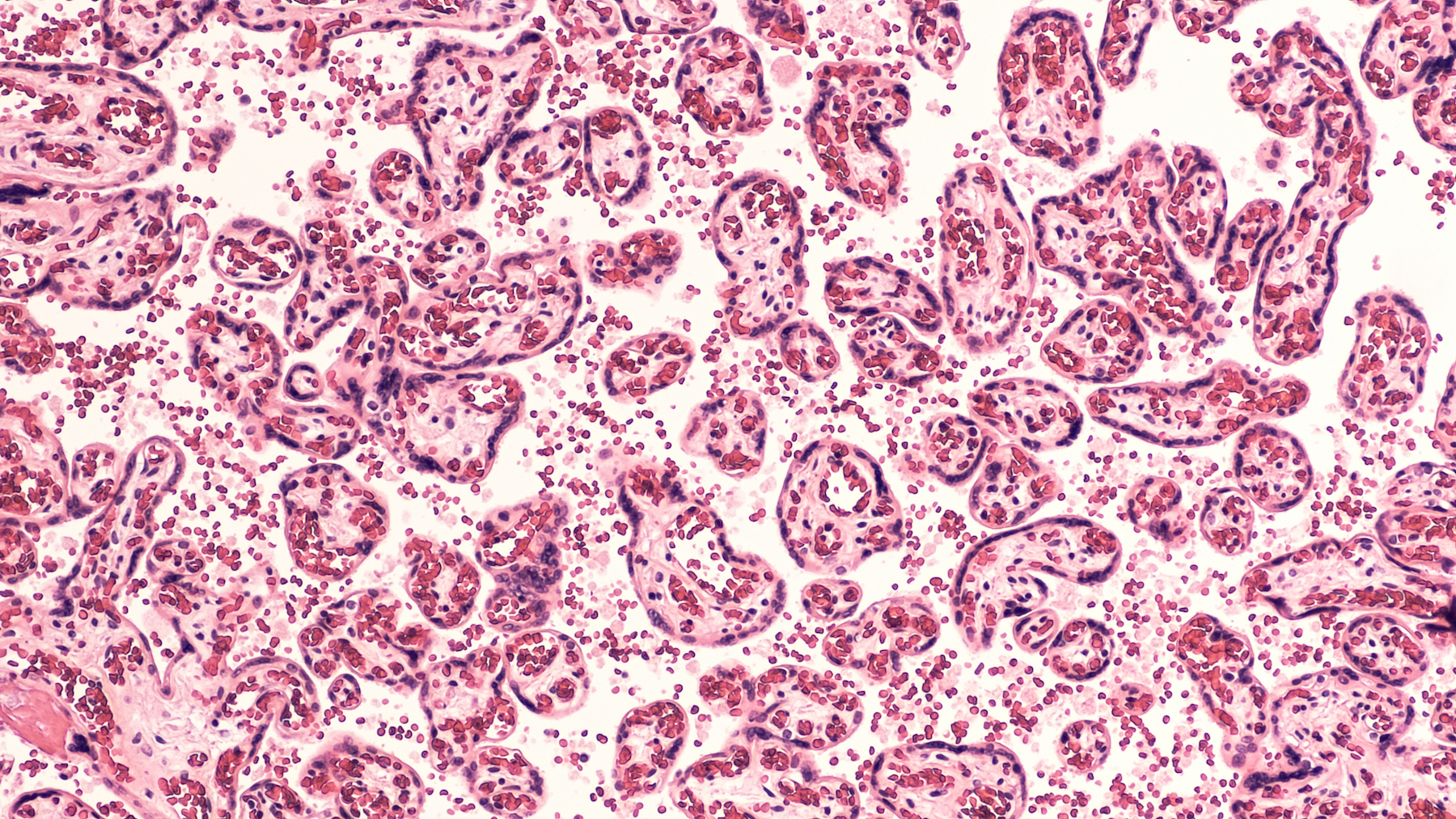 Microscopic image of red and pink cells with globular shapes against a white background.