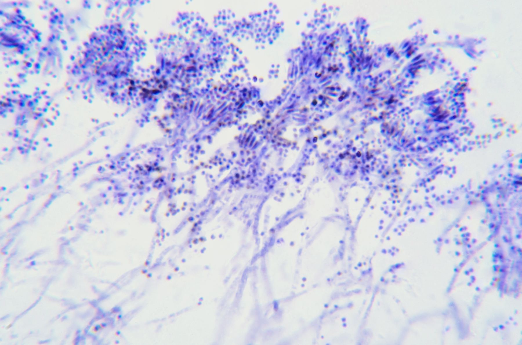 "Dark Fungi" Species Don't Get Names. Should They? - Vimarsana News