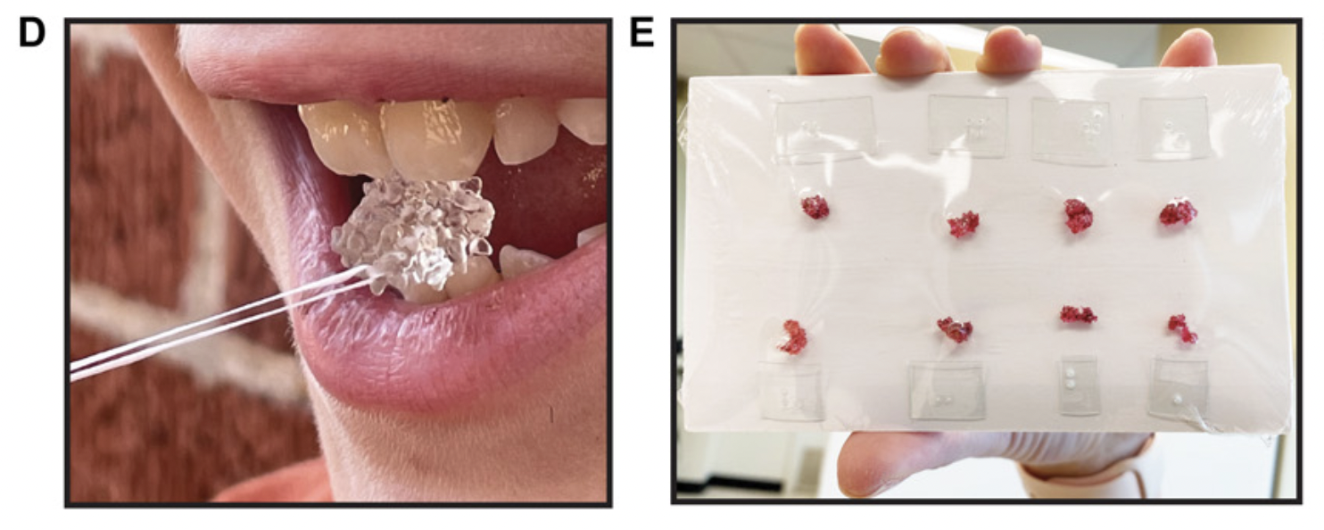 Left: A texturally complex translucent object passing through a person's mouth. Right: A hand holds up an index card with 8 popcorn kermel-sized red objects shrink wrapped on its surface.