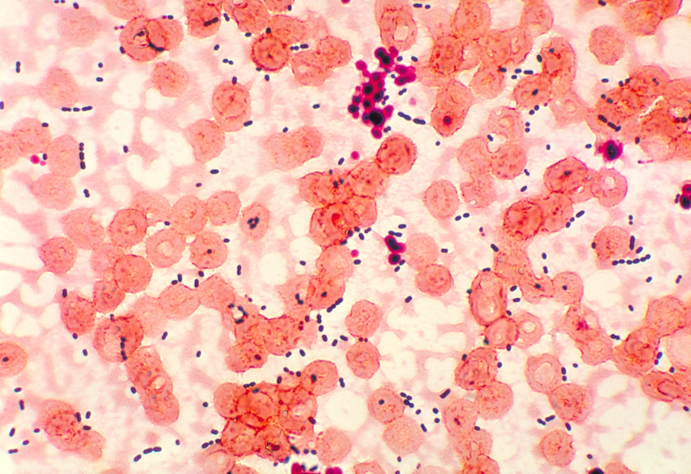 Tissue cells (red) infected with a small bacterium (purple).