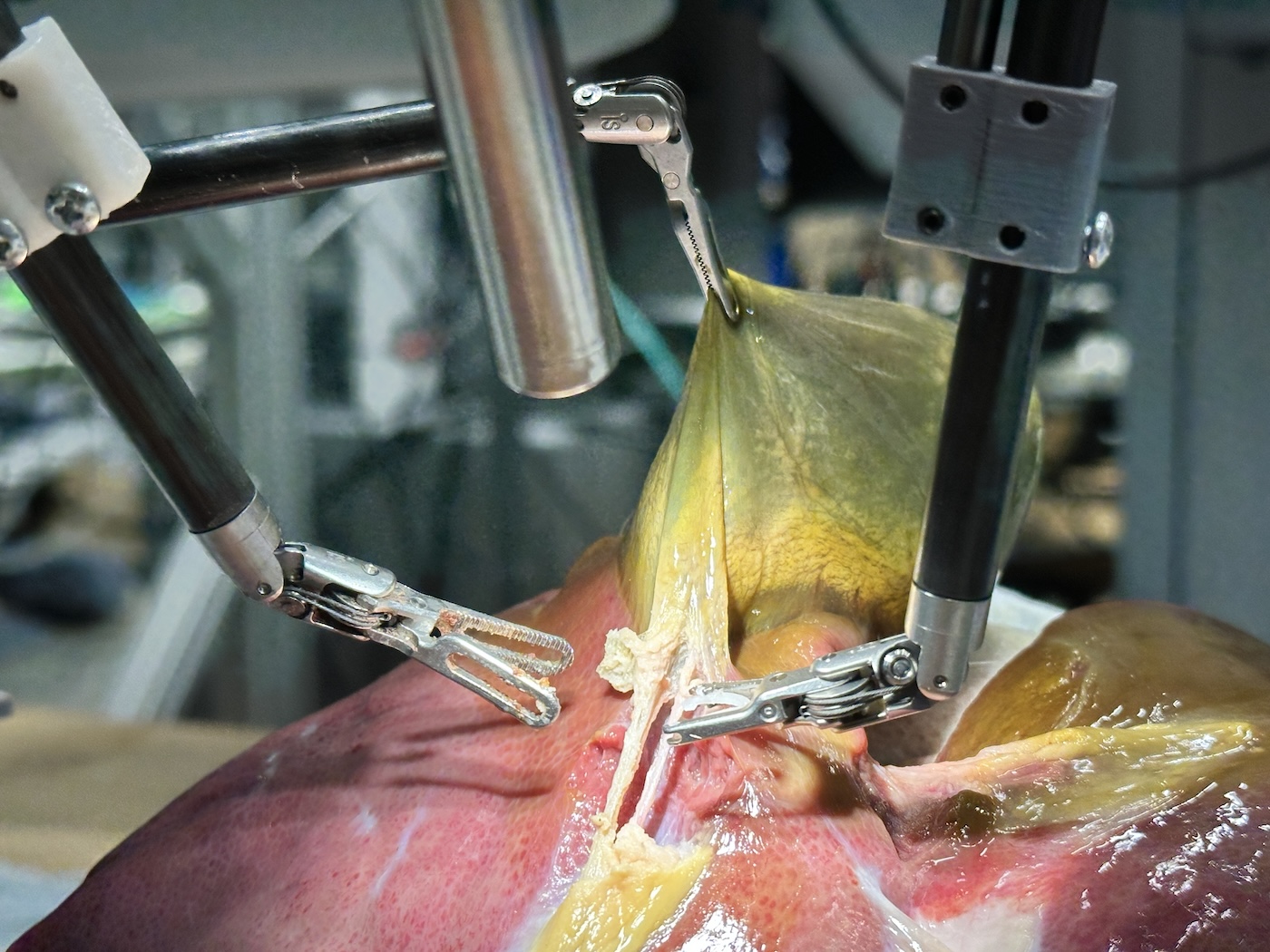 Metal prongs grabbing organs.