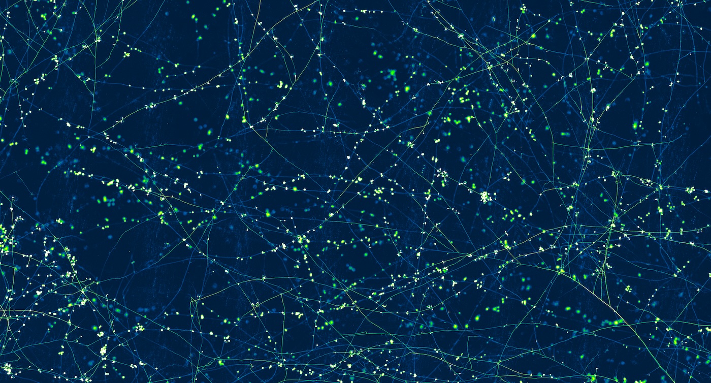Strands of green thin fibers spreading across a blue background.