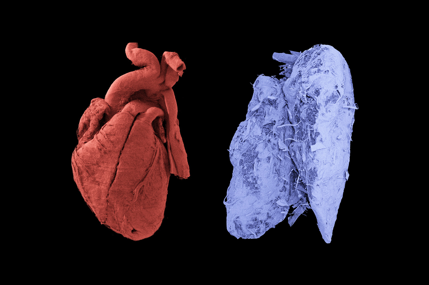 How a particle accelerator illuminated 56 human organs