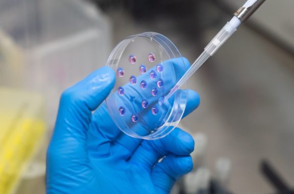 3-D miniature tumors from brain tumor patients