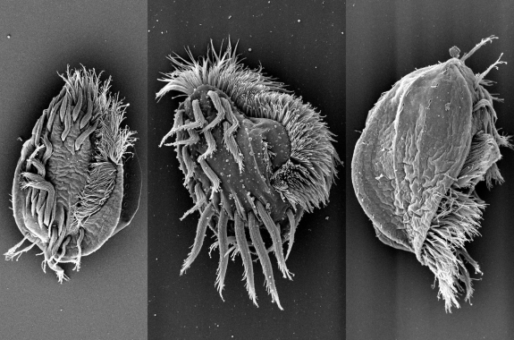 3 black-and-white microscopic images of a cell with hairy-looking fringe, and many leg-like appendages.