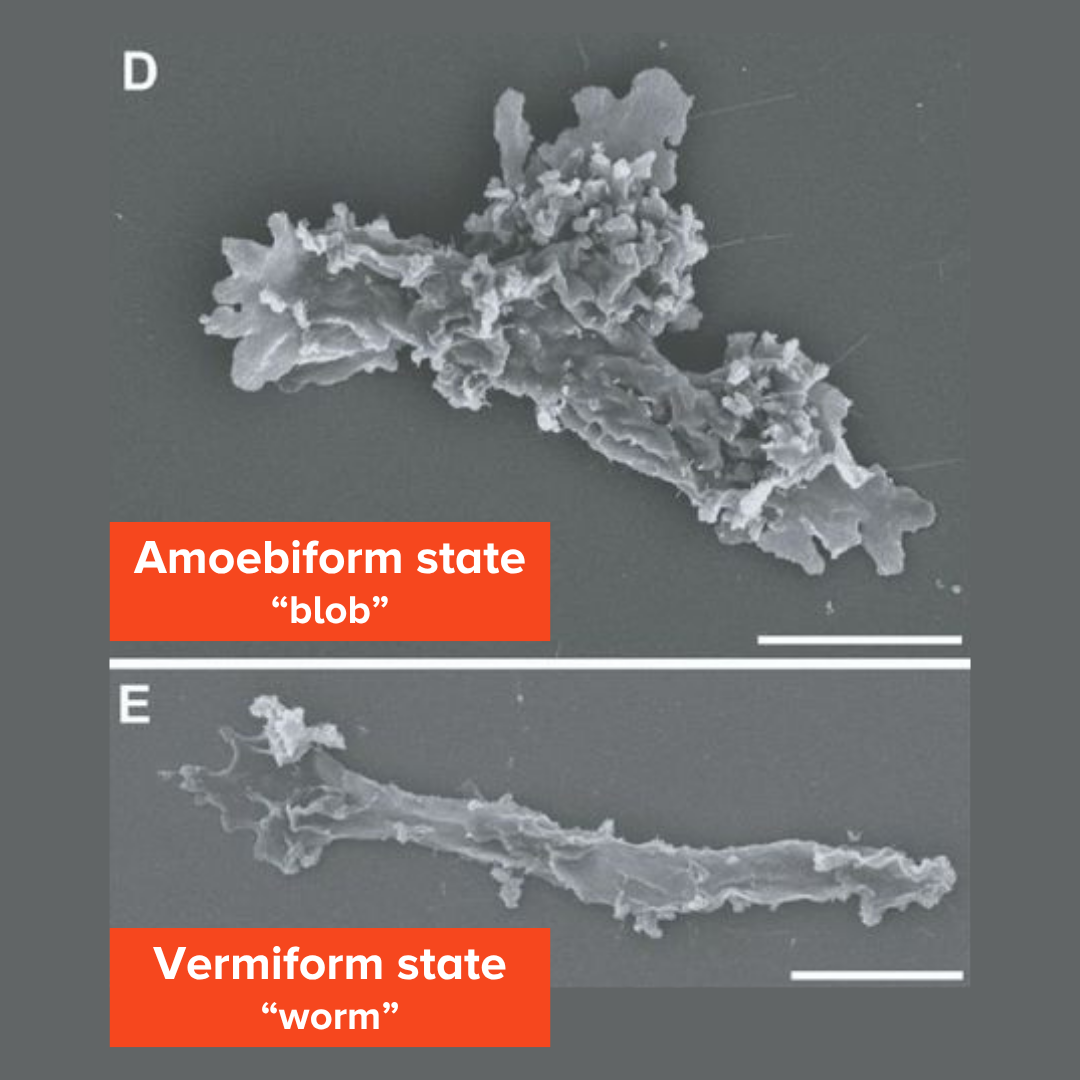 Two gray scanning electron microscope images showing the same microorganism in two different body shapes: a spread-out, irregular blob called the amoebiform state on top, and a long, narrow worm shape called the vermiform state on the bottom.