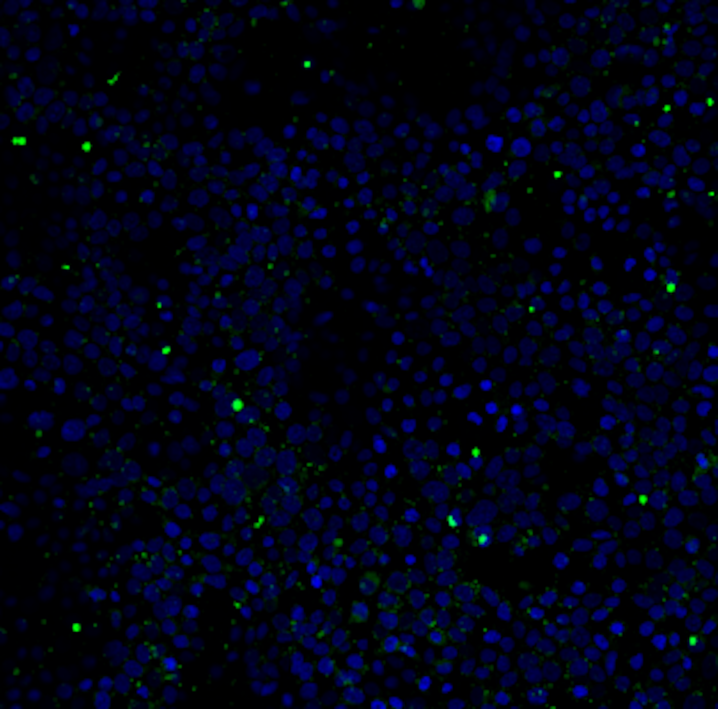 A dark background filled with small blue blobs and occasional bright green dots of varying sizes.