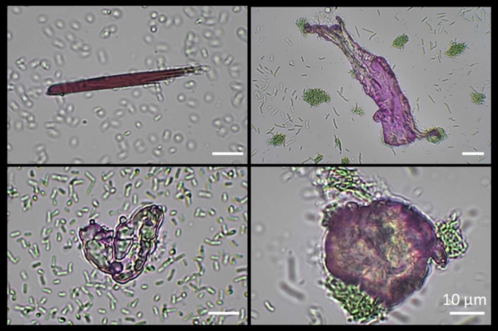 Four microscope images show small green algae and large pieces of purple microplastic. On the left are two slides showing the algae floating near the plastic. On the right, two images show clumps of algae attached to the plastic. In the bottom right corner, white text reads 10 𝝻m. Under the text is a small white line that represents that distance.